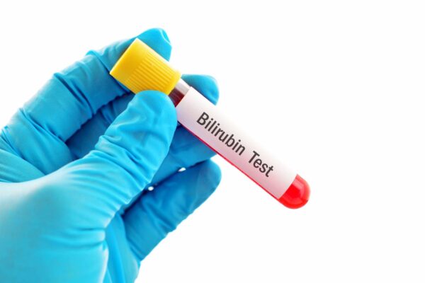<span class="notranslate">BILIRUBINE TOTALE-DIRECT</span>