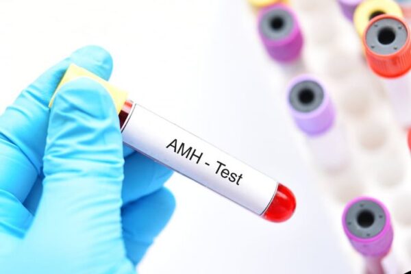 <span class="notranslate">AMH</span>