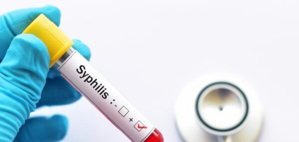<span class="notranslate">BW-SYPHILIS</span>