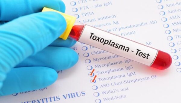 <span class="notranslate">Toxoplasmose IGG-IGM</span>