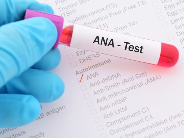 <span class="notranslate">AC-Anti Nucléaire (ANA)</span>