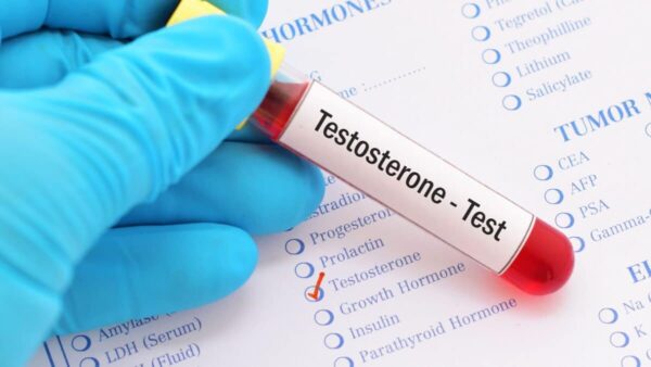 <span class="notranslate">Testostérone</span>